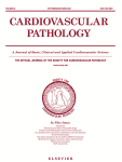 Characterization of heart disease in mucopolysaccharidosis type II mice
