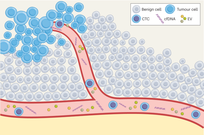 Diagnostic liquid biopsy biomarkers in renal cell cancer