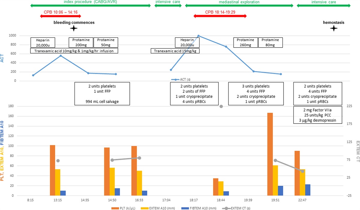 Undiagnosed Factor VII Deficiency in Cardiac Surgery Complicated by Bleeding: A Case Report