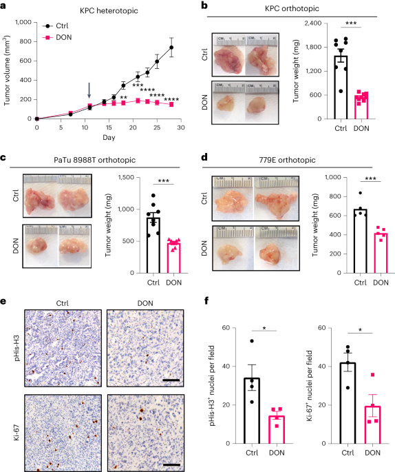 Glutamine mimicry suppresses tumor progression through asparagine metabolism in pancreatic ductal adenocarcinoma
