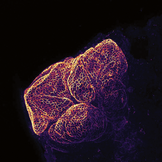 Understanding remodelling of bile ducts to promote polycystic liver disease