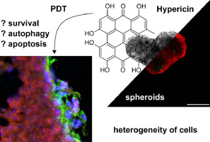 Imaging of heterogeneity in 3D spheroids of U87MG glioblastoma cells and its implications for photodynamic therapy