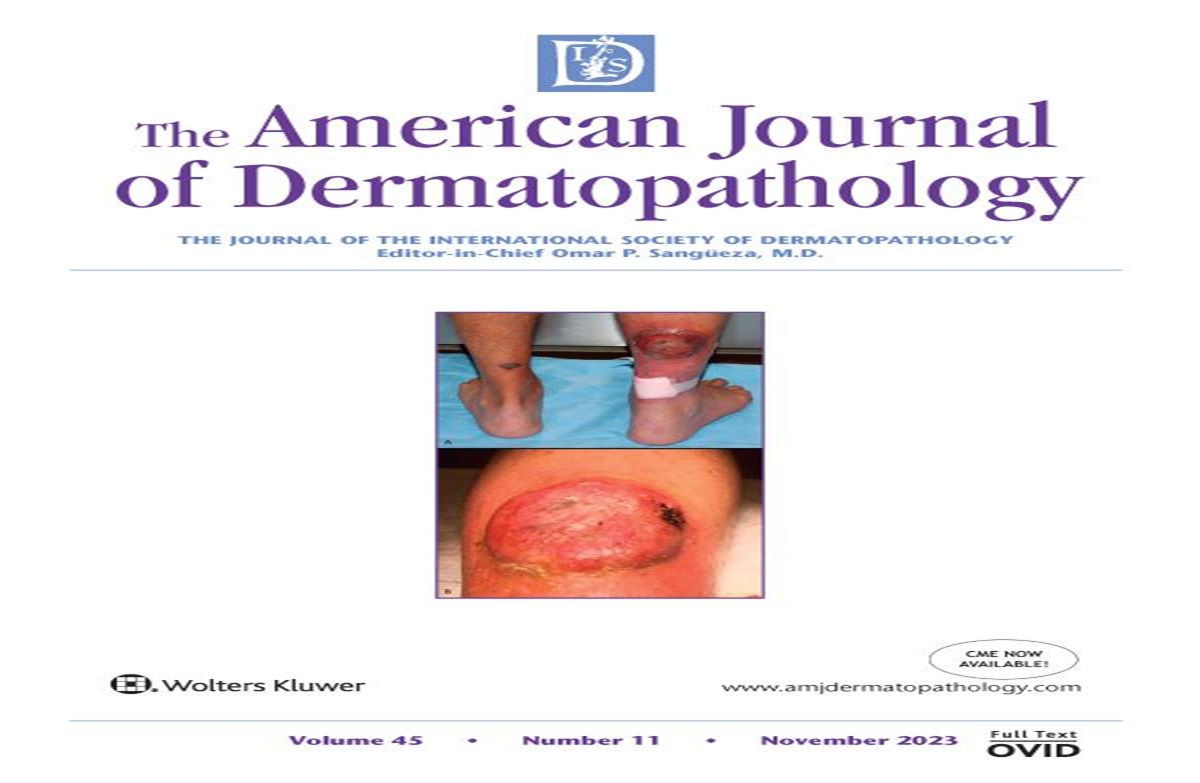 Cutaneous Metastasis of Sarcomatoid Renal Cell Carcinoma, A Clinicopathologic Challenge