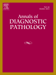 Spitz tumor with RAF1 fusion: A report of 3 cases