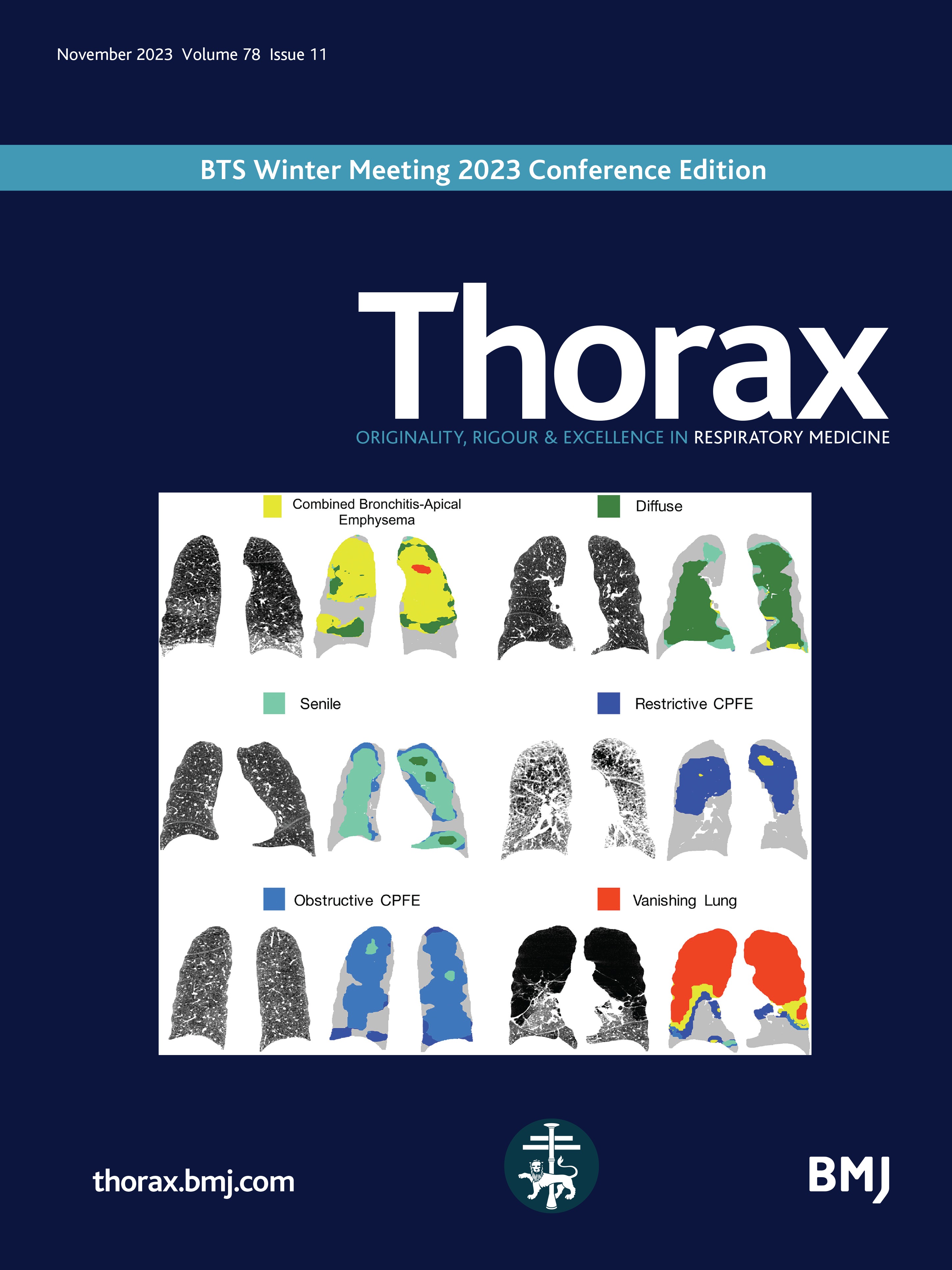 Pulmonary emphysema subtypes defined by unsupervised machine learning on CT scans