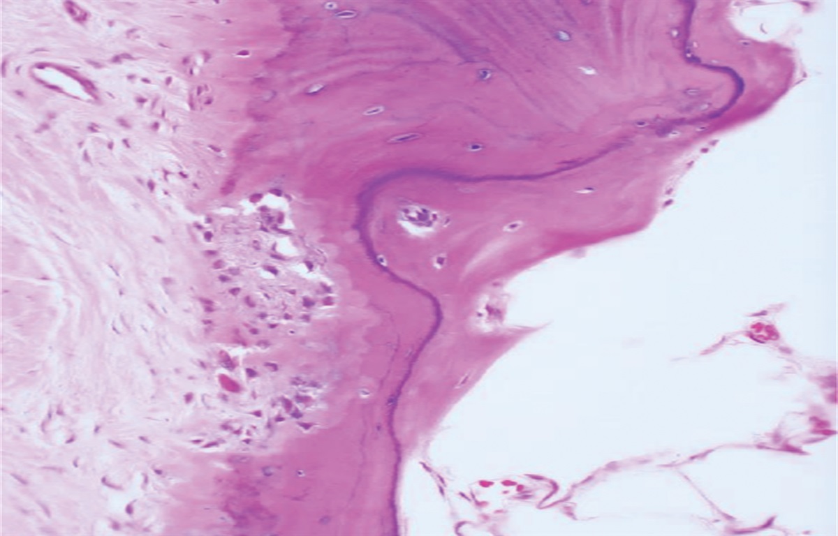 Bone Homeostasis and Physiology in Normal and Orthopaedic Disease Conditions