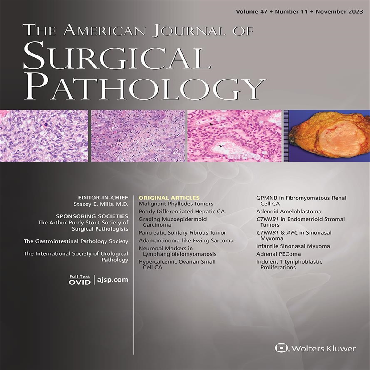 Richard L. Kempson, MD, RIP