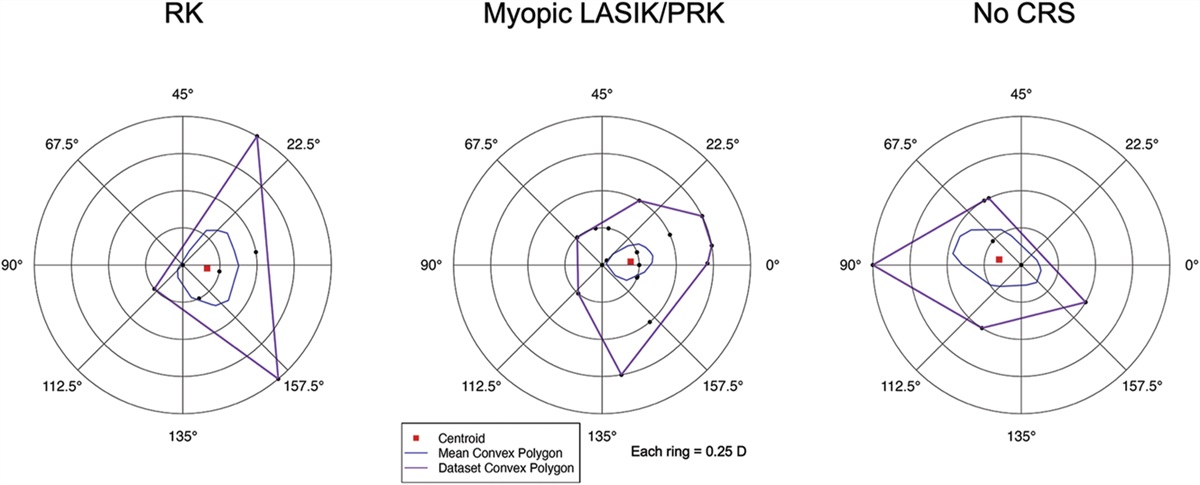 Early outcomes of second-generation light-adjustable lenses in eyes with and without corneal refractive surgery