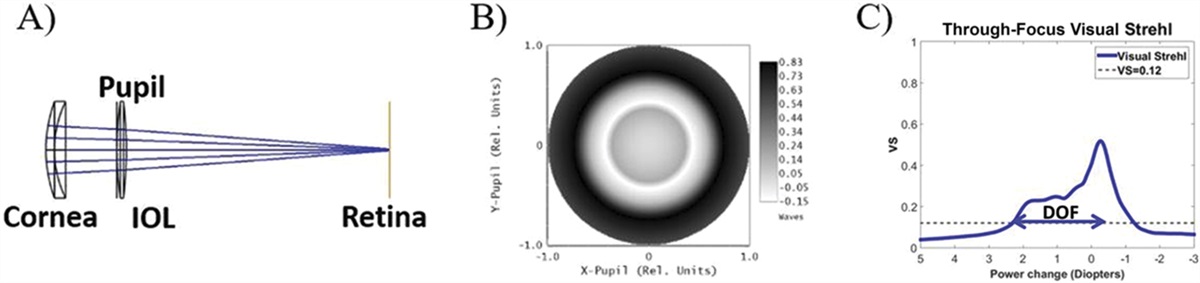Computational simulation of the optical performance of an EDOF intraocular lens in post-LASIK eyes