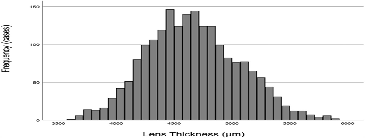 Association between anterior chamber biometry and posterior capsular defects