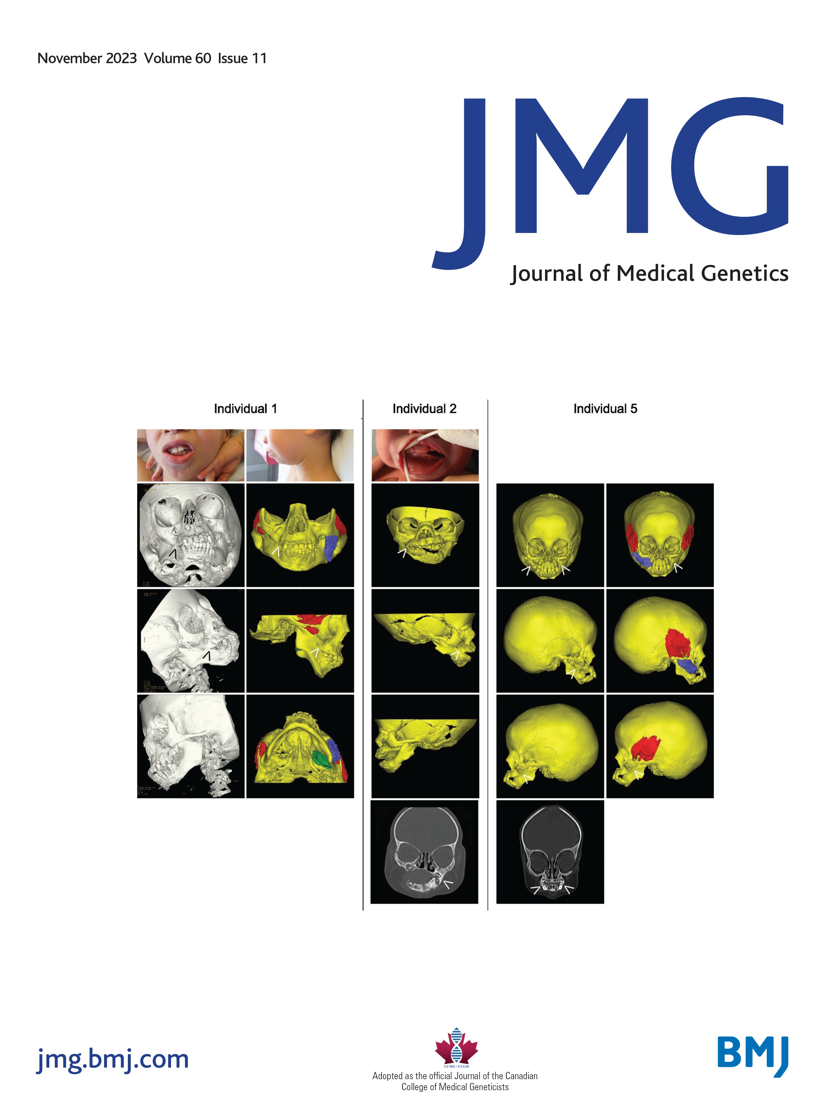 Position statement of the International Society for Gastrointestinal Hereditary Tumours (InSiGHT) on APC I1307K and cancer risk