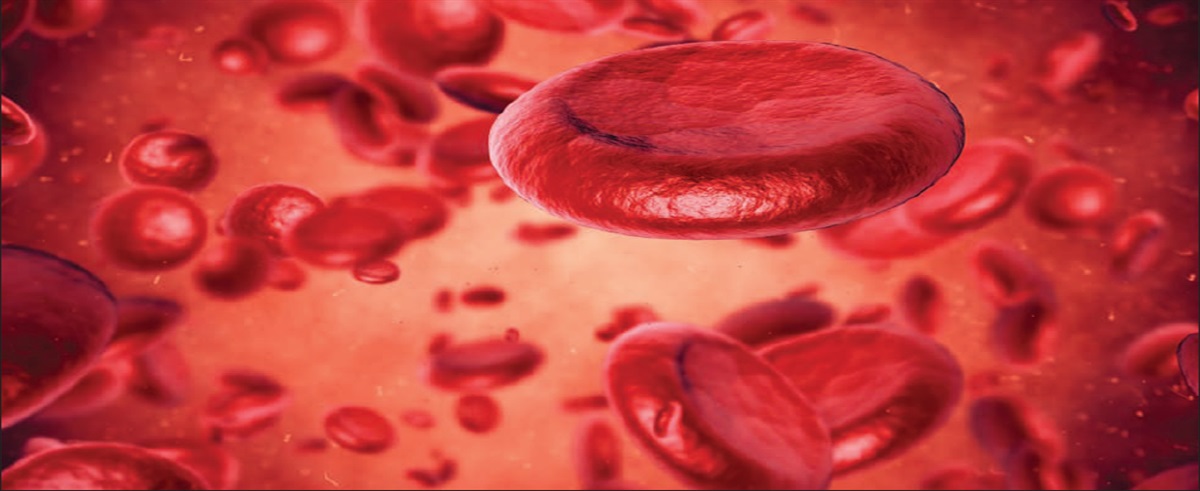 Pernicious anemia: A case report of diligence to diagnosis