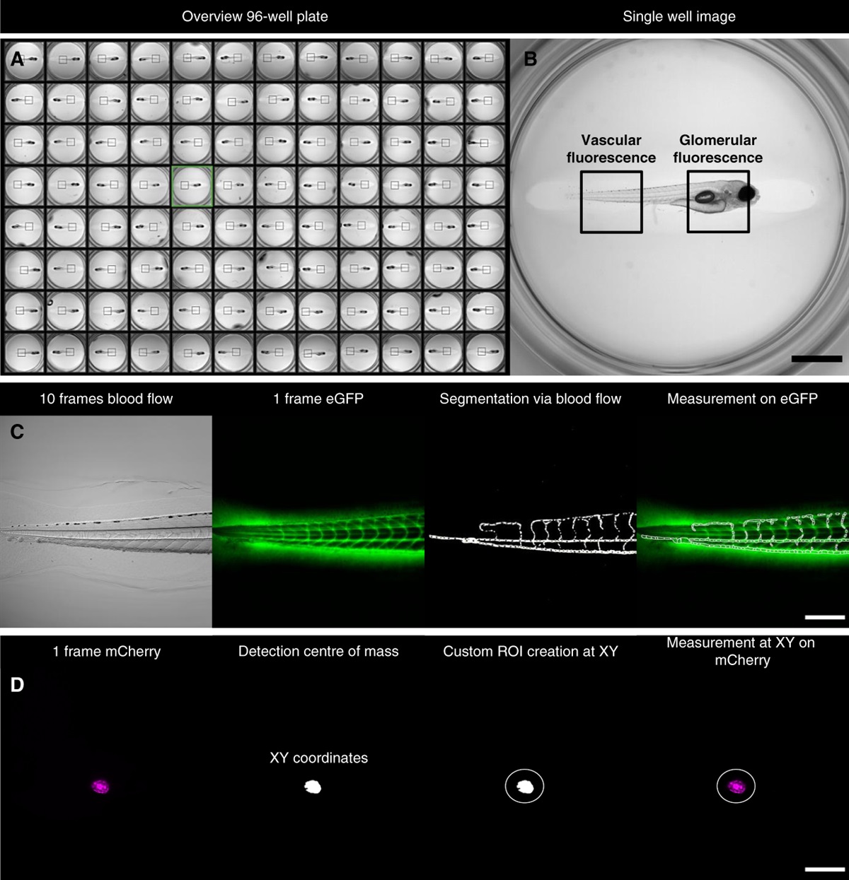 A Novel High-Content Screening Assay Identified Belinostat as Protective in a FSGS—Like Zebrafish Model