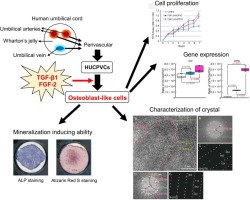 Synergistic Effect of FGF-2 and TGF-β1 on the Mineralization of Human Umbilical Cord Perivascular Cells