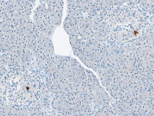 Antivirals in the treatment of new-onset T1DM