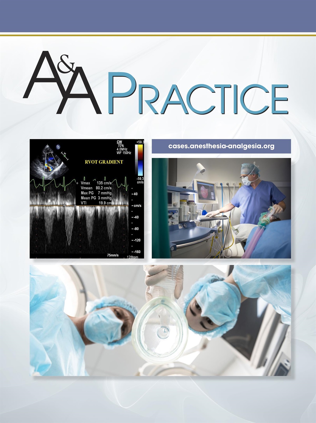 Reactivation of Herpes Simplex Virus Following Sphenopalatine Ganglion Nerve Block: Case Report and Review of the Literature
