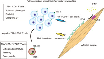 Pathogenicity of functionally activated PD-1+CD8+ cells and counterattacks by muscular PD-L1 through IFNγ in myositis