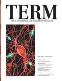 Understanding the Multi-Functional Role of TCTP in the Regeneration Process of Earthworm, Perionyx excavatus