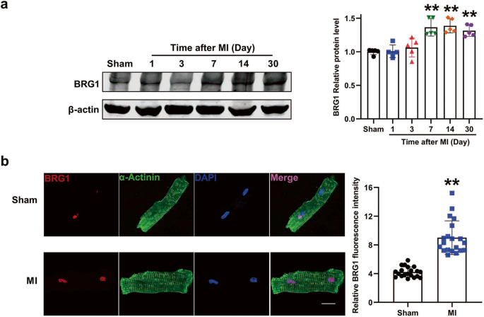 Cardiac-specific deletion of BRG1 ameliorates ventricular arrhythmia in mice with myocardial infarction