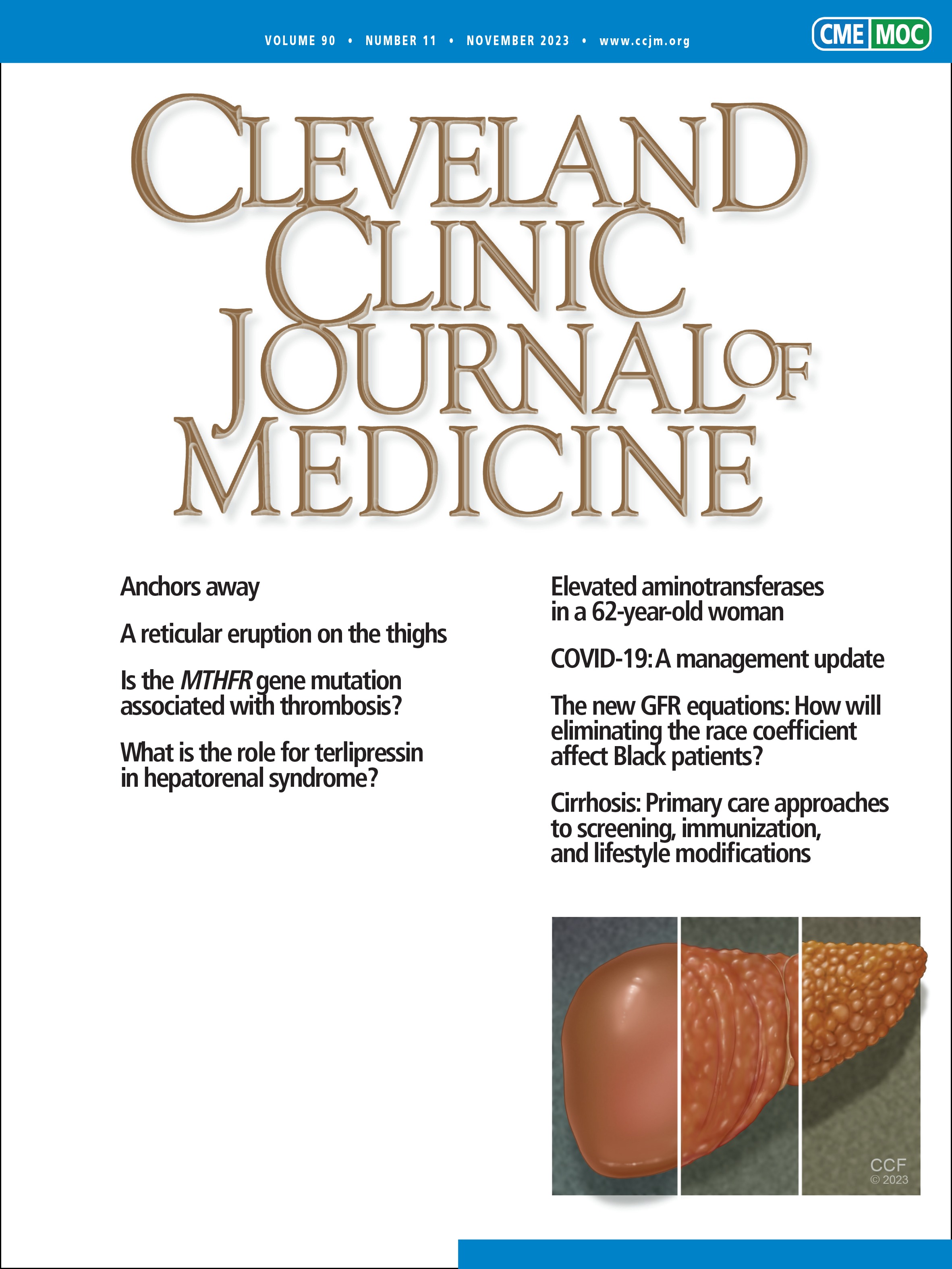 What is the role for terlipressin in hepatorenal syndrome?
