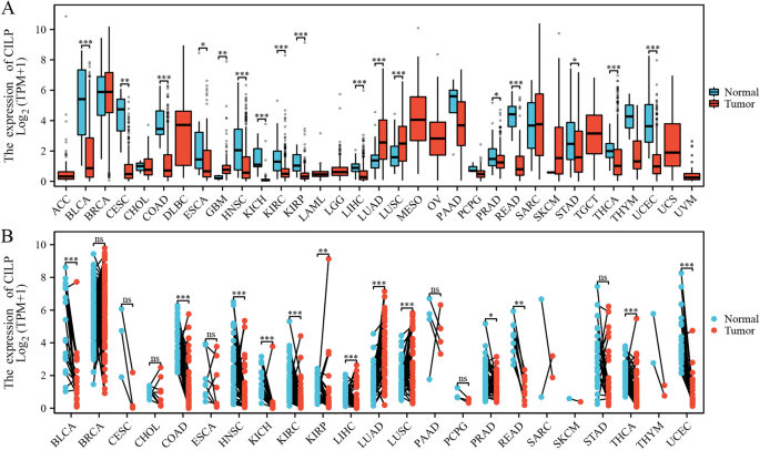 CILP is a potential pan-cancer marker: combined silico study and in vitro analyses