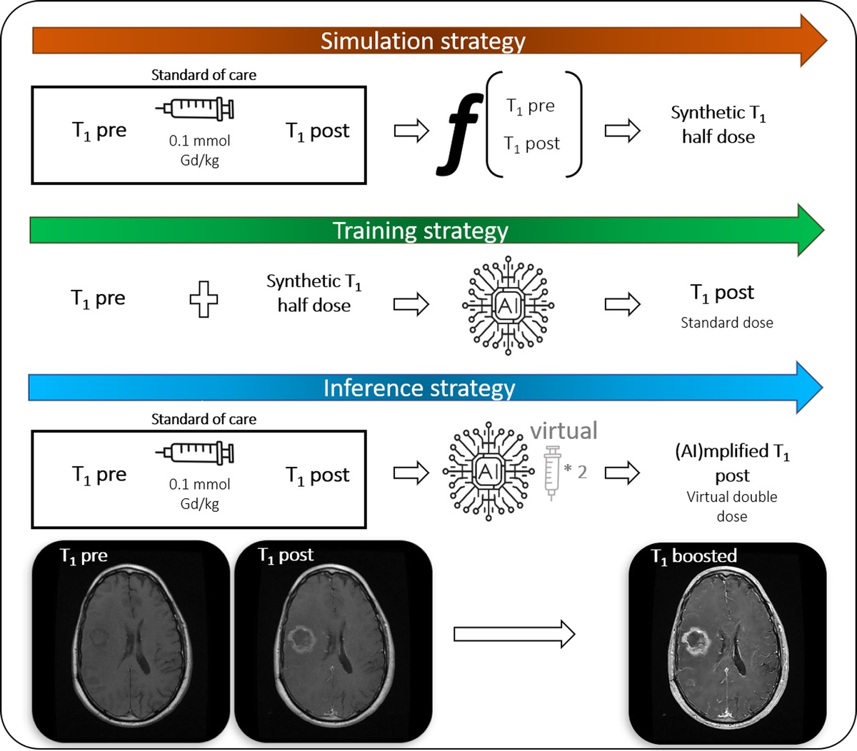 Amplifying the Effects of Contrast Agents on Magnetic Resonance Images Using a Deep Learning Method Trained on Synthetic Data