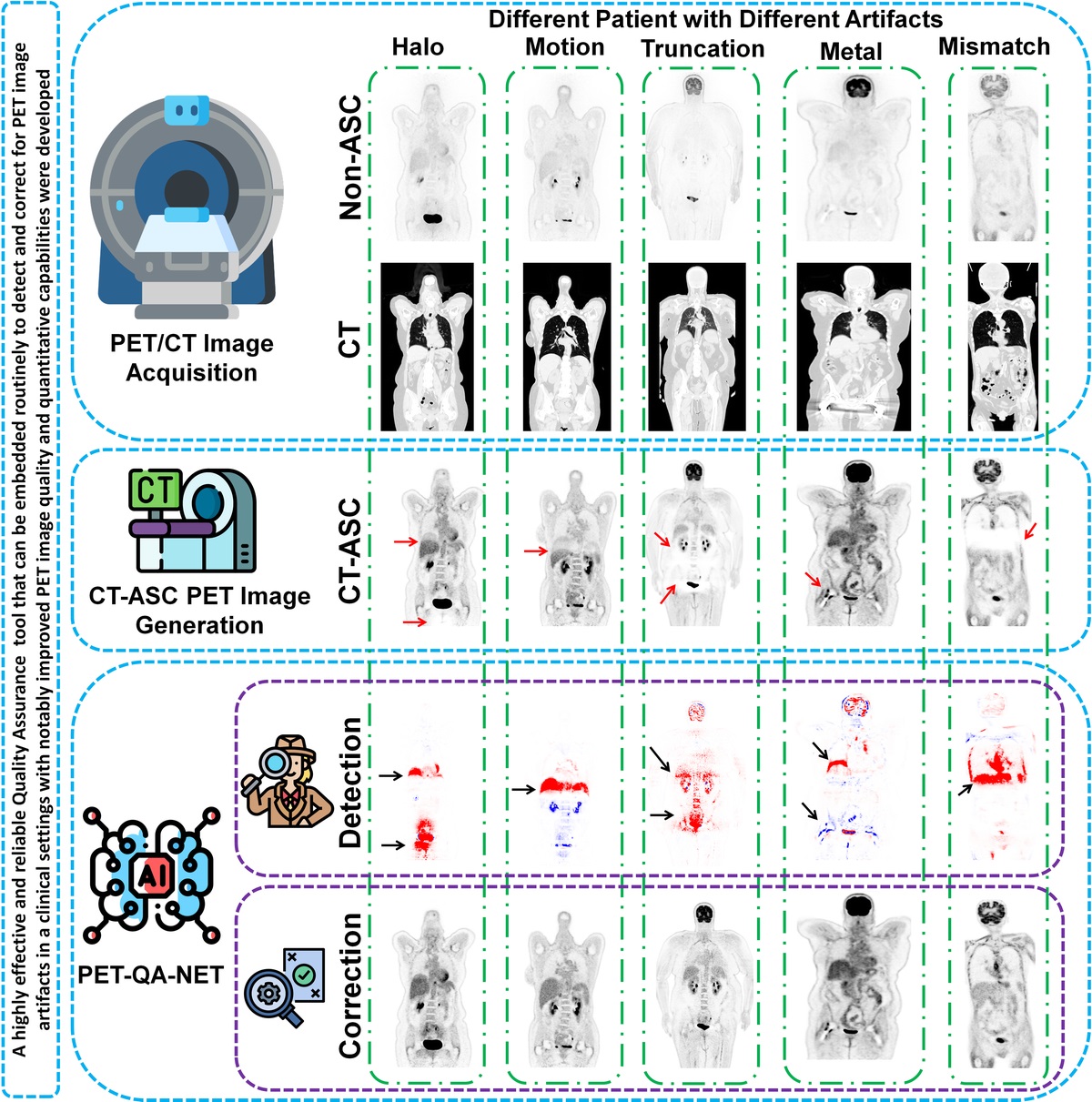Artificial Intelligence–Driven Single-Shot PET Image Artifact Detection and Disentanglement: Toward Routine Clinical Image Quality Assurance