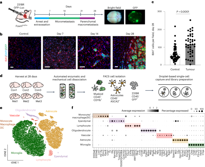 Microglia promote anti-tumour immunity and suppress breast cancer brain metastasis