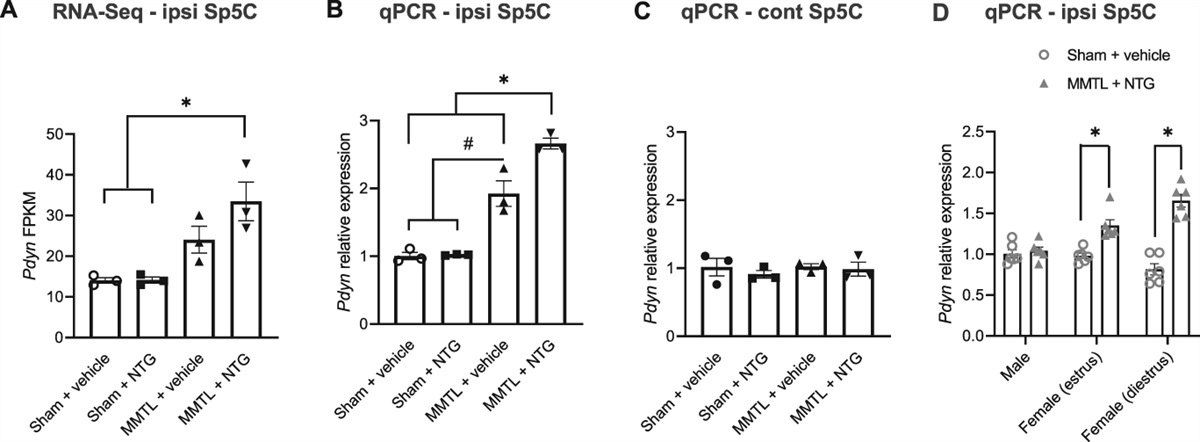 A female-specific role for trigeminal dynorphin in orofacial pain comorbidity