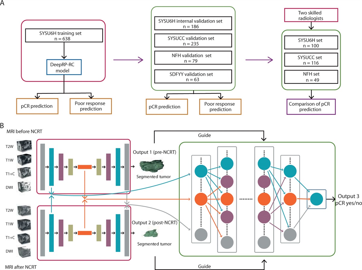 A Longitudinal MRI-Based Artificial Intelligence System to Predict Pathological Complete Response After Neoadjuvant Therapy in Rectal Cancer: A Multicenter Validation Study