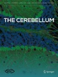 A Comparative Perspective on the Cerebello-Cerebral System and Its Link to Cognition