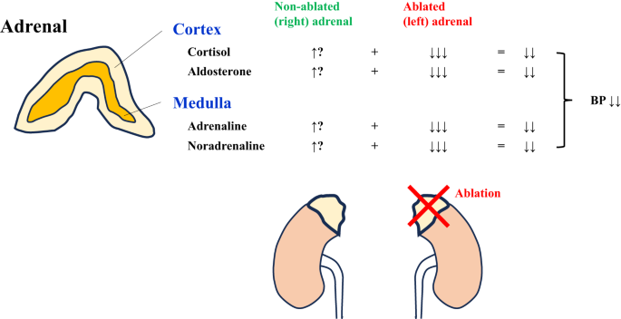 Lowering of blood pressure by chemical ablation of the unilateral adrenal gland in spontaneously hypertensive rats