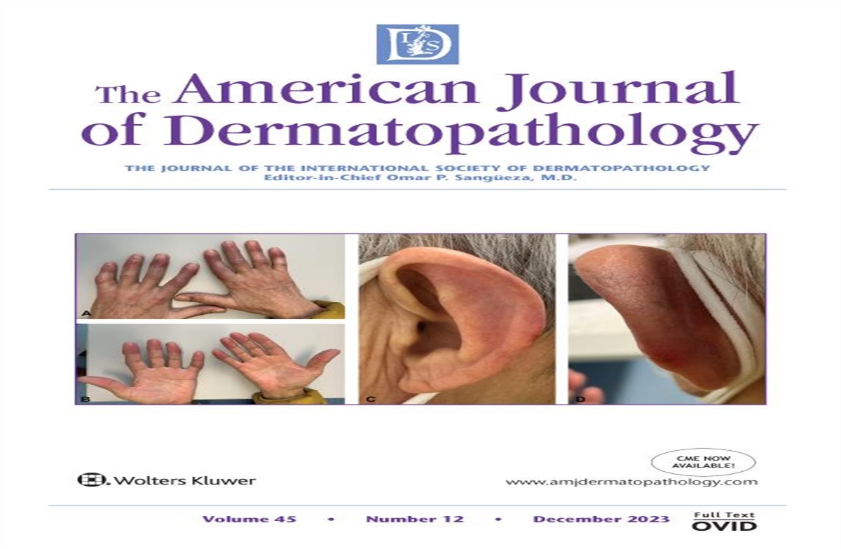 Concomitant AESOP and POEMS Syndrome in the Context of Osseous and Cutaneous Plasmacytomas: Answer
