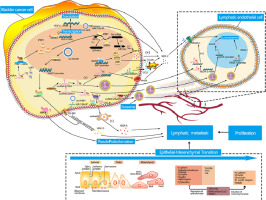 Molecular mechanism of microRNAs, long noncoding RNAs, and circular RNAs regulating lymphatic metastasis of bladder cancer
