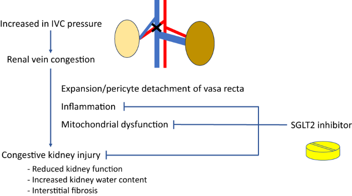 Sodium glucose cotransporter 2 inhibitor as a promising therapy for congestive kidney injury