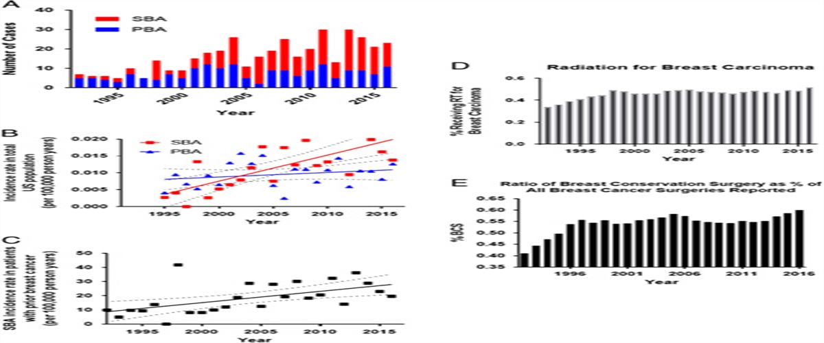 Secondary Breast Angiosarcoma After a Primary Diagnosis of Breast Cancer: A Retrospective Analysis of the Surveillance, Epidemiology, and End Results (SEER) Database