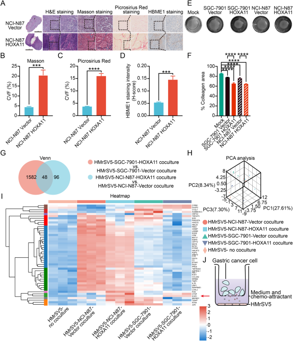 Tumor-mesothelium HOXA11-PDGF BB/TGF β1-miR-181a-5p-Egr1 feedforward amplifier circuity propels mesothelial fibrosis and peritoneal metastasis of gastric cancer