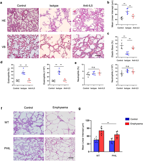 Correction: Eosinophils promote pulmonary matrix destruction and emphysema via Cathepsin L
