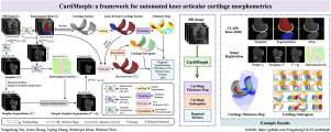 CartiMorph: A framework for automated knee articular cartilage morphometrics