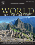 Kernohan-Woltman Notch Phenomenon Following Acute Subdural Hematoma