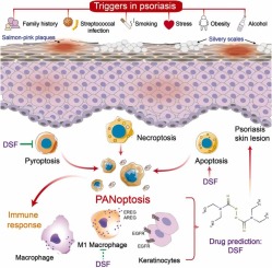 PANoptosis Signaling Enables Broad Immune Response in Psoriasis: From Pathogenesis to New Therapeutic Strategies