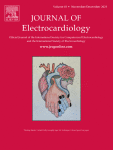 Association between excess catecholamine synthesis and polymorphic premature ventricular contraction