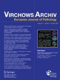 Immunohistochemical markers as predictors of prognosis in multifocal prostate cancer