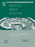 Riemannian frameworks for the harmonization of resting-state functional MRI scans