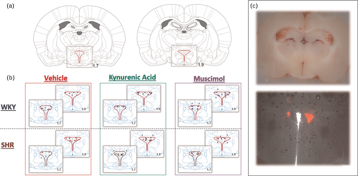 Inactivation of the paraventricular nucleus attenuates the cardiogenic sympathetic afferent reflex in the spontaneously hypertensive rat