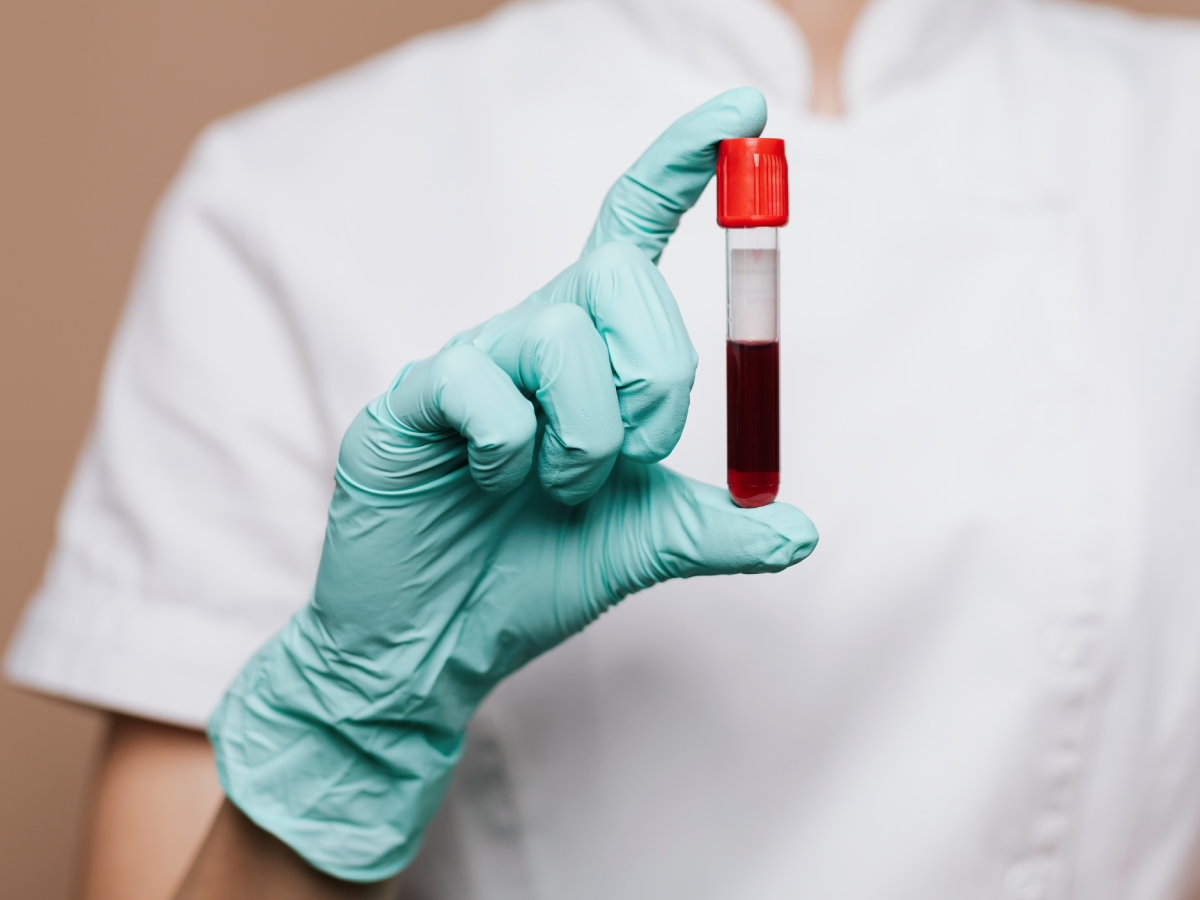 Exploring Whether the Electronic Optimization of Routine Health Assessments Can Increase Testing for Sexually Transmitted Infections and Provider Acceptability at an Aboriginal Community Controlled Health Service: Mixed Methods Evaluation