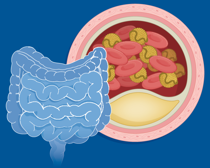 New insights into dietary cholesterol absorption