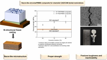 Bio-inspired nacre-like zirconia/PMMA composites for chairside CAD/CAM dental restorations