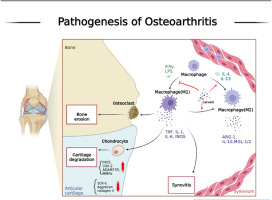 Carveol alleviates osteoarthritis progression by acting on synovial macrophage polarization transformation: An in vitro and in vivo study