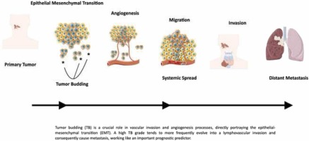 Tumor budding is a prognostic factor in head and neck squamous cell carcinoma: A comprehensive meta-analysis and trial sequential analysis